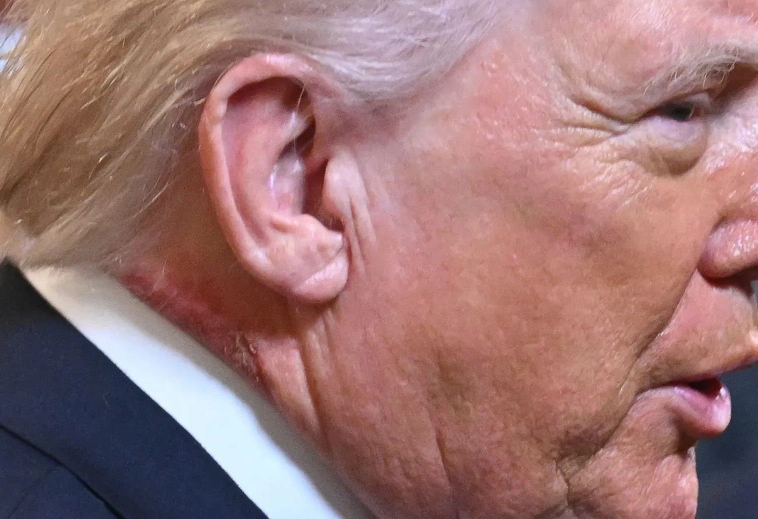 Donald_Trump's_Neck.jpg (250 KB)